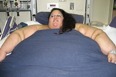 obese-woman.jpg